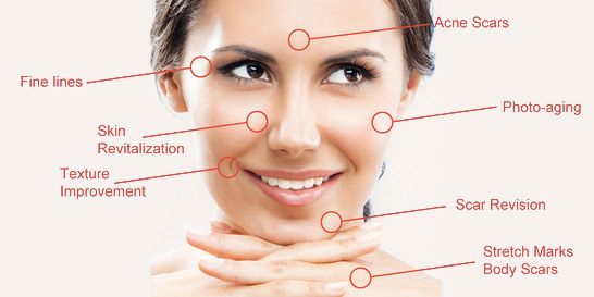 Online Microneedling Training and Certification - Doctor Certified